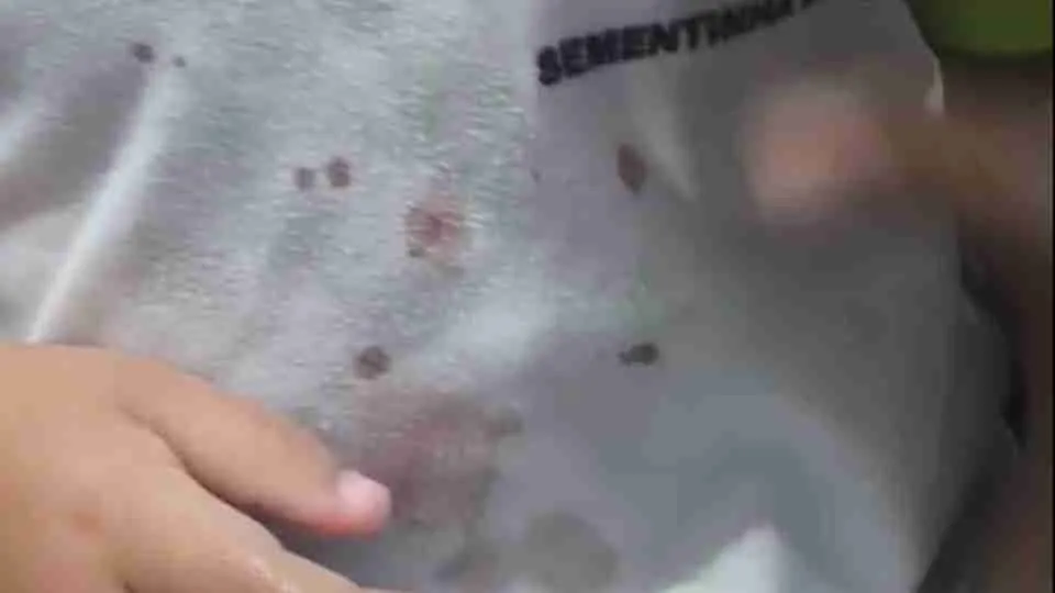 Padrasto é investigado por tortura contra menina de 2 anos em Palotina