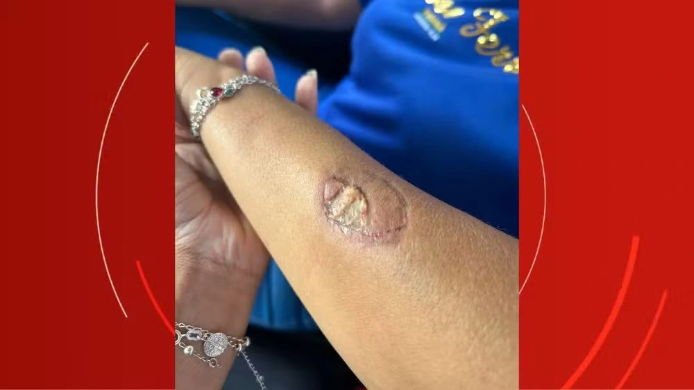 M&atilde;e de aluno agride funcion&aacute;rias e morde vice-diretora dentro de escola no Paran&aacute;