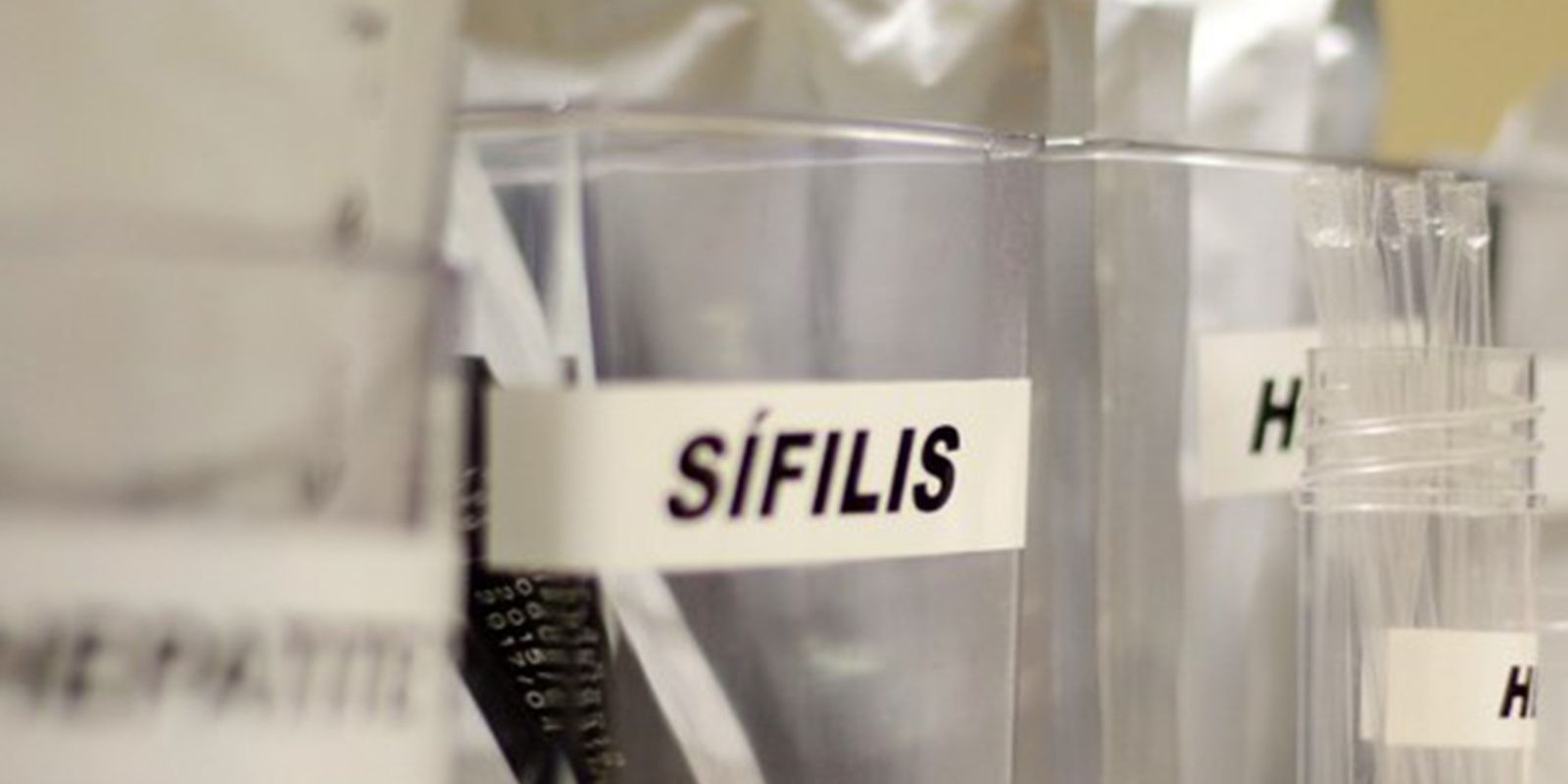 Centro de SP tem testagem gr&aacute;tis de HIV, hepatite, s&iacute;flis e gonorreia