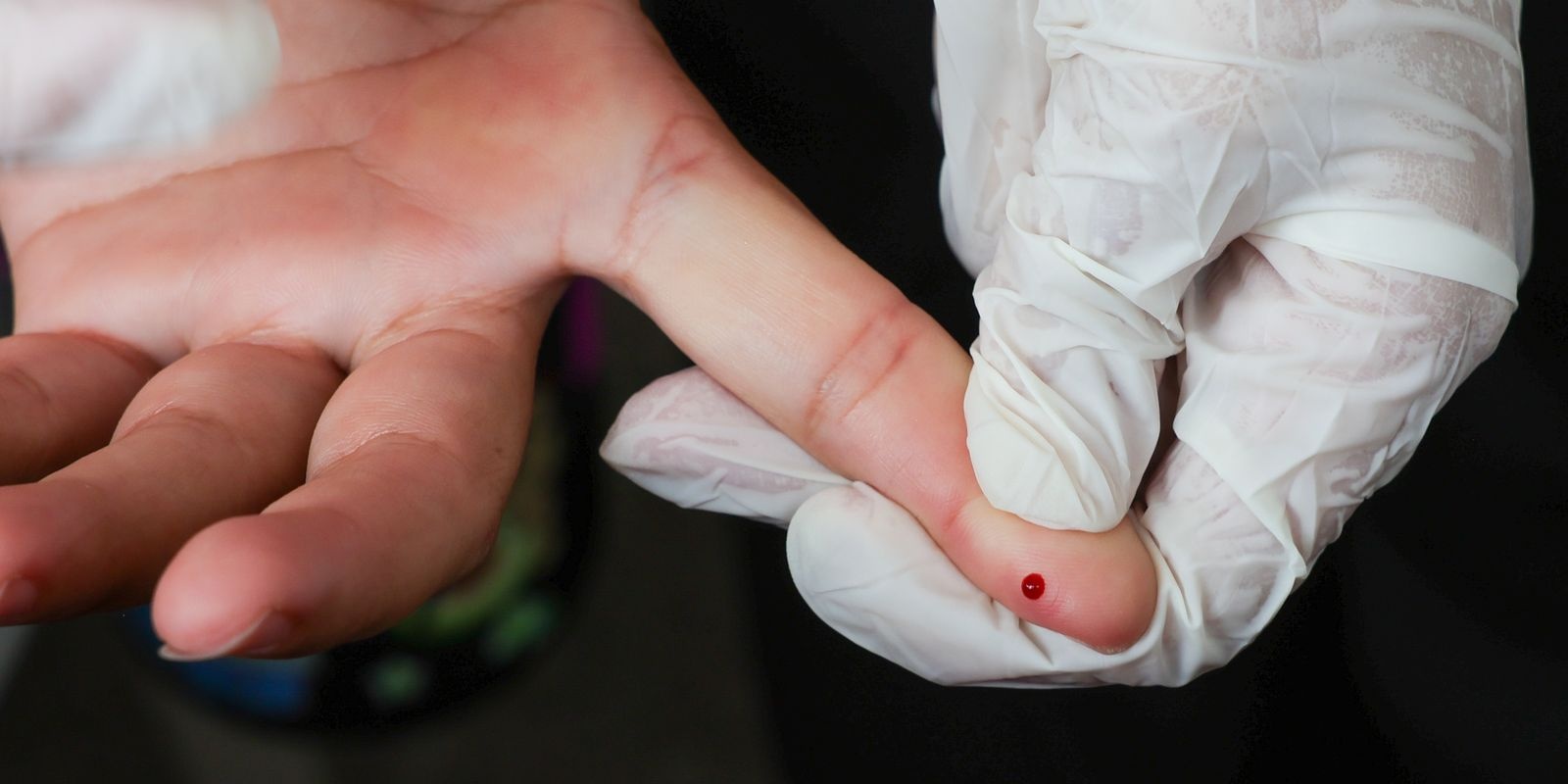 SUS passa a oferecer teste r&aacute;pido de dengue