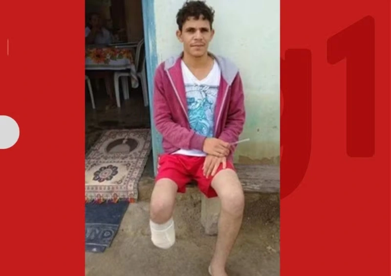 P&eacute; de servidor que amputou o pr&oacute;prio membro para receber R$ 1,5 milh&atilde;o foi encontrado dentro da mochila dele