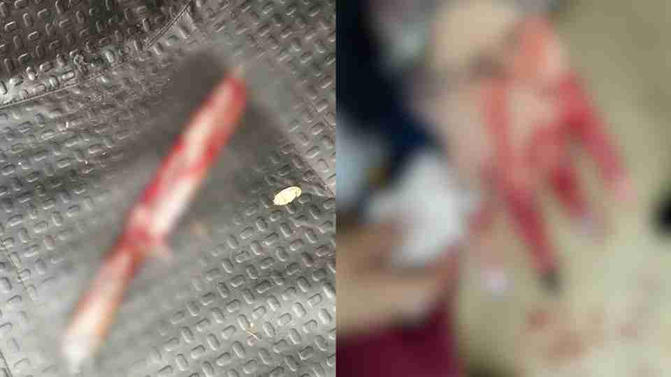 Casal fica ferido após ser esfaqueado no interior do PR